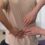 Sciatica Treatment in Tijuana: Non-Surgical Orthobiologic Solutions for Pain Relief